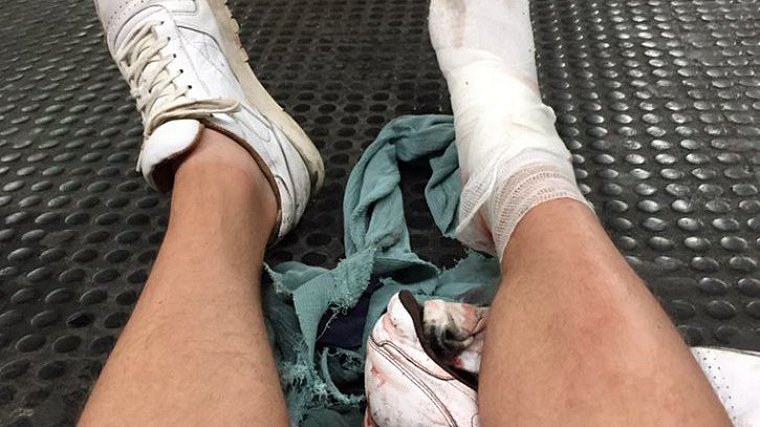 30 фанатов ЦСКА пострадали в римском метро, 7 — в тяжелом состоянии - фото